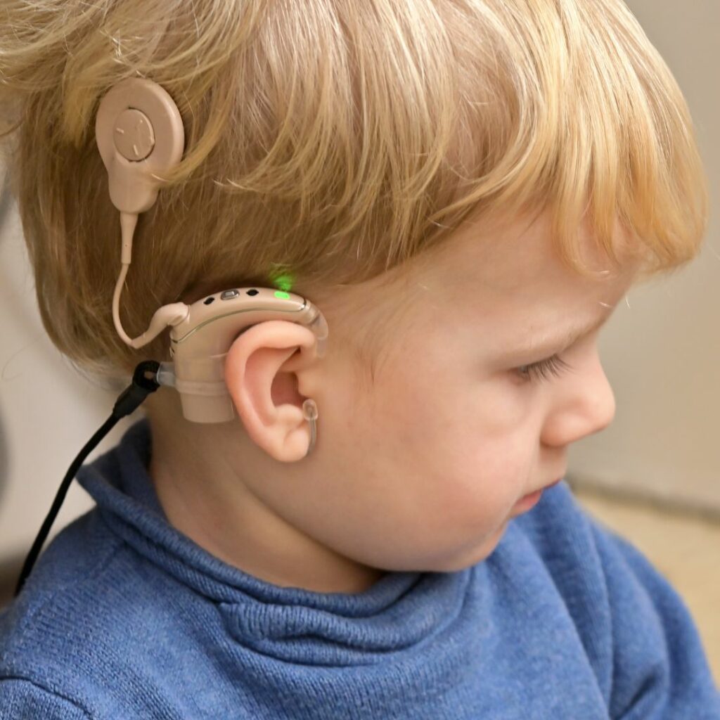 a little boy is sitting down and wearing a beige colored cochlear implant