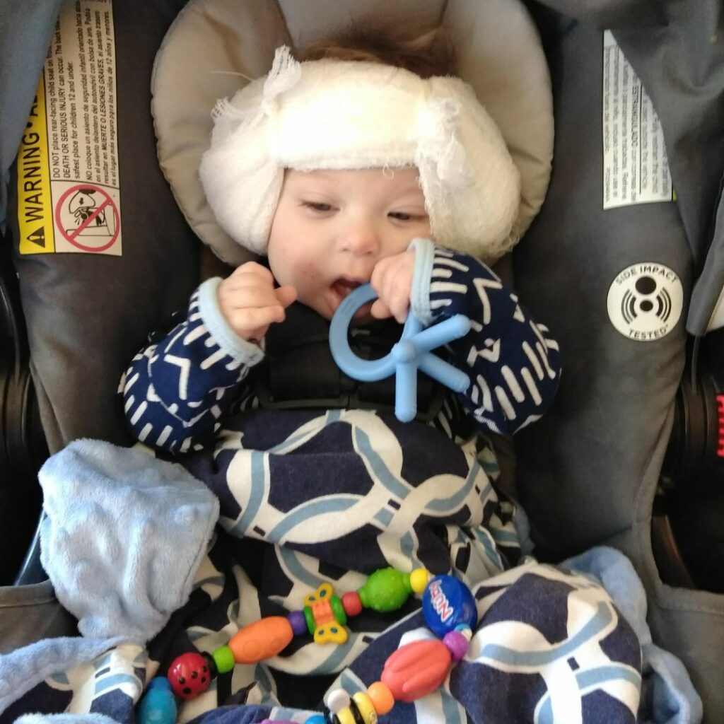 a baby sits in a car seat and is chewing on a toy. the baby has a gauze wrap around his head after cochlear implant surgery.